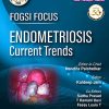 FOGSI Focus Endometriosis Current Trends (PDF)