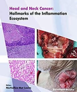 Head and Neck Cancer: Hallmarks of The Inflammation Ecosystem-Volume 2 (EPUB & Converted PDF)