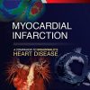 Myocardial Infarction: A Companion to Braunwald’s Heart Disease (PDF)