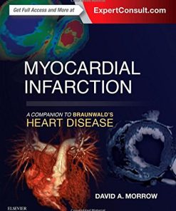 Myocardial Infarction: A Companion to Braunwald’s Heart Disease (PDF)