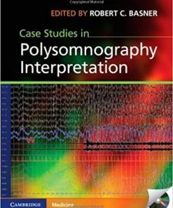 Case Studies in Polysomnography Interpretation (PDF)