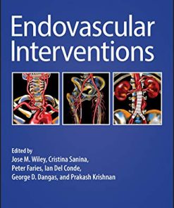 Endovascular Interventions