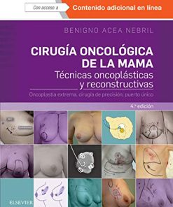 Cirugía oncológica de la mama: Técnicas oncoplásticas y reconstructivas. Oncoplastia extrema, cirugía de precisión, puerto único (Spanish Edition) (PDF)