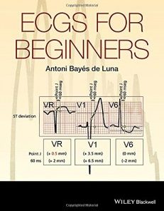 ECGs for Beginners