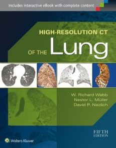 High-Resolution CT of the Lung, 5th Edition (PDF)