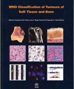 WHO Classification of Tumours of Soft Tissue and Bone (IARC WHO Classification of Tumours) (Retail PDF)