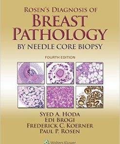 Rosen’s Diagnosis of Breast Pathology by Needle Core Biopsy, 4th Edition (EPUB)