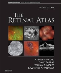 The Retinal Atlas, 2th Edition