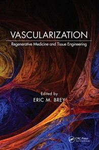 Vascularization: Regenerative Medicine and Tissue Engineering