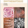 Systemic Lupus Erythematosus: Visual Guide for Clinicians (PDF)