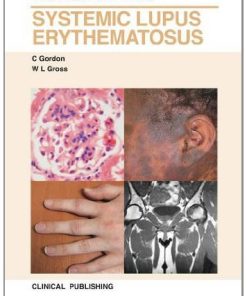 Systemic Lupus Erythematosus: Visual Guide for Clinicians (PDF)