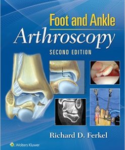 Foot & Ankle Arthroscopy, 2nd Edition (EPUB)