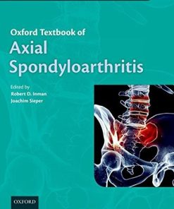 Oxford Textbook of Axial Spondyloarthritis (Oxford Textbooks in Rheumatology) (Retail PDF)