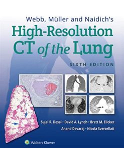 Webb, Müller and Naidich’s High-Resolution CT of the Lung, 6ed (ePub+azw3+Converted PDF)