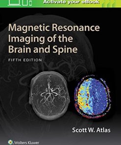 Magnetic Resonance Imaging of the Brain and Spine, 5th Edition (PDF)