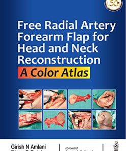 Free Radial Artery Forearm Flap For Head And Neck Reconstruction: A Color Atlas (PDF)