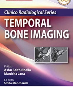 Clinico Radiological Series: Temporal Bone Imaging, 2nd Edition (PDF)
