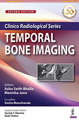 Clinico Radiological Series: Temporal Bone Imaging, 2nd Edition (PDF) Clinico Radiological Series: Temporal Bone Imaging, 2nd Edition (PDF)