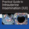 Practical Guide To Intrauterine Insemination (IUI) (PDF)