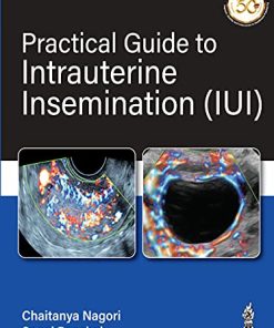 Practical Guide To Intrauterine Insemination (IUI) (PDF)