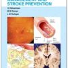 Blood Pressure Management and Stroke Prevention (Visual Guide for Clinicians) (PDF)