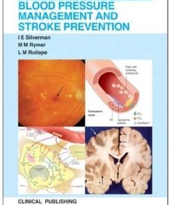 Blood Pressure Management and Stroke Prevention (Visual Guide for Clinicians) (PDF)