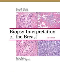 Biopsy Interpretation of the Breast, 3rd Edition (EPUB+Converted PDF)