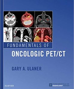 Fundamentals of Oncologic PET/CT (Fundamentals of Radiology) (PDF)