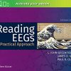 Reading EEGs: A Practical Approach, 2nd Edition (PDF)