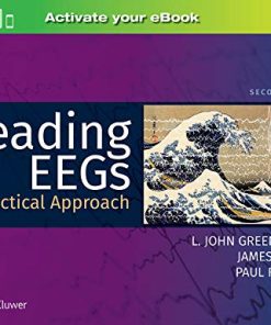 Reading EEGs: A Practical Approach, 2nd Edition (PDF)