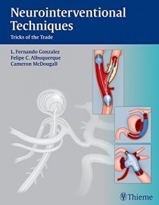 Neurointerventional Techniques: Tricks of the Trade (PDF)