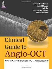 Clinical Guide to Angio-OCT: Non Invasive, Dyeless OCT Angiography