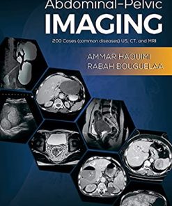 Abdominal-Pelvic Imaging: 200 Cases (Common Diseases): US, CT and MRI (EPUB)