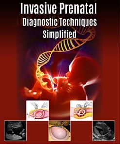 Ultrasound Guided Invasive Prenatal Diagnostic Techniques Simplified (PDF)