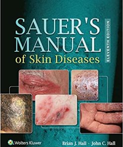 Sauer’s Manual of Skin Diseases, 11th Edition (Epub)