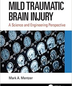 Mild Traumatic Brain Injury: A Science and Engineering Perspective (PDF)