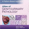 Atlas of Genitourinary Pathology: A Pattern Based Approach (EPUB)
