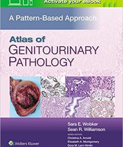 Atlas of Genitourinary Pathology: A Pattern Based Approach (EPUB)
