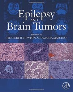 Epilepsy and Brain Tumors