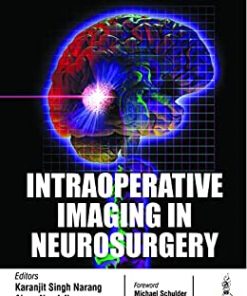 Intraoperative Imaging in Neurosurgery (PDF)