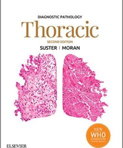 Diagnostic Pathology: Thoracic, 2nd Edition (EPUB)