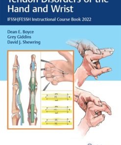 Tendon Disorders of the Hand and Wrist: IFSSH/FESSH Instructional Course Book 2022 (PDF)