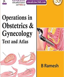 Operations in Obstetrics & Gynecology: Text And Atlas (PDF)