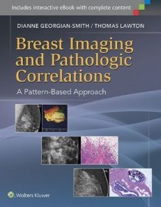 Breast Imaging and Pathologic Correlations: A Pattern-Based Approach (PDF)