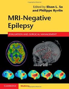 MRI-Negative Epilepsy: Evaluation and Surgical Management (EPUB)