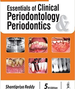 Essentials of Clinical Periodontology and Periodontics 5th Edition (PDF)