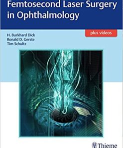 Femtosecond Laser Surgery in Ophthalmology (PDF Book + Videos)