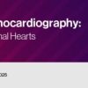 2022 Fetal Echocardiography: Normal and Abnormal Hearts (CME VIDEOS)