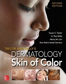 Taylor and Kelly’s Dermatology for Skin of Color, 2nd Edition (ePUB)