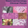 Gastroenterology Clinical Focus: High yield GI and hepatology review- for Boards and Practice – 3rd edition (PDF)
